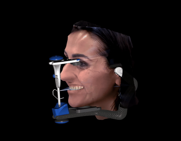 Digital articulation workflow