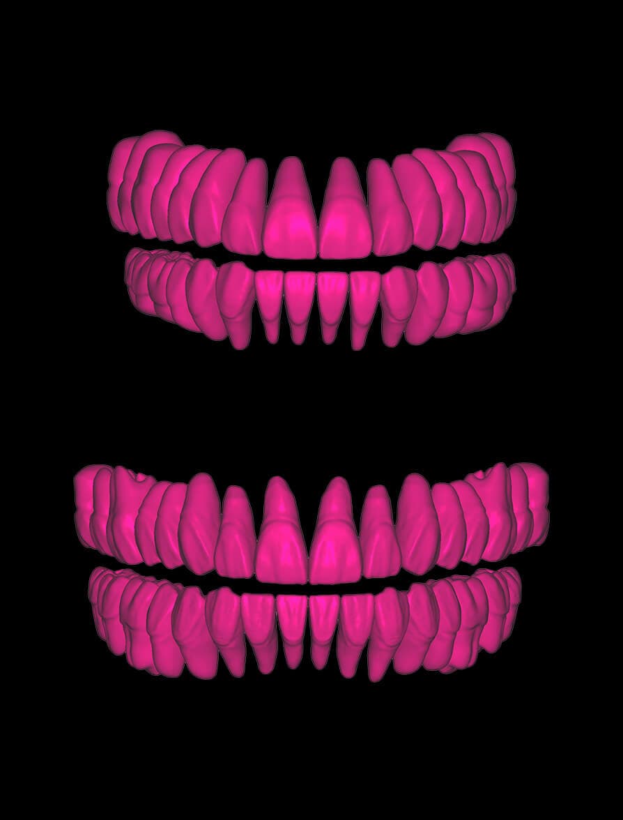 MOD exocad Tooth Libraries