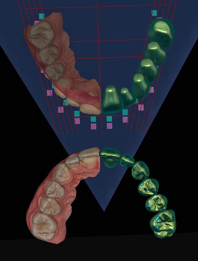 Mod Institute Full Mouth Restorations Mini-Residency - The MOD Institute | The MOD ...
