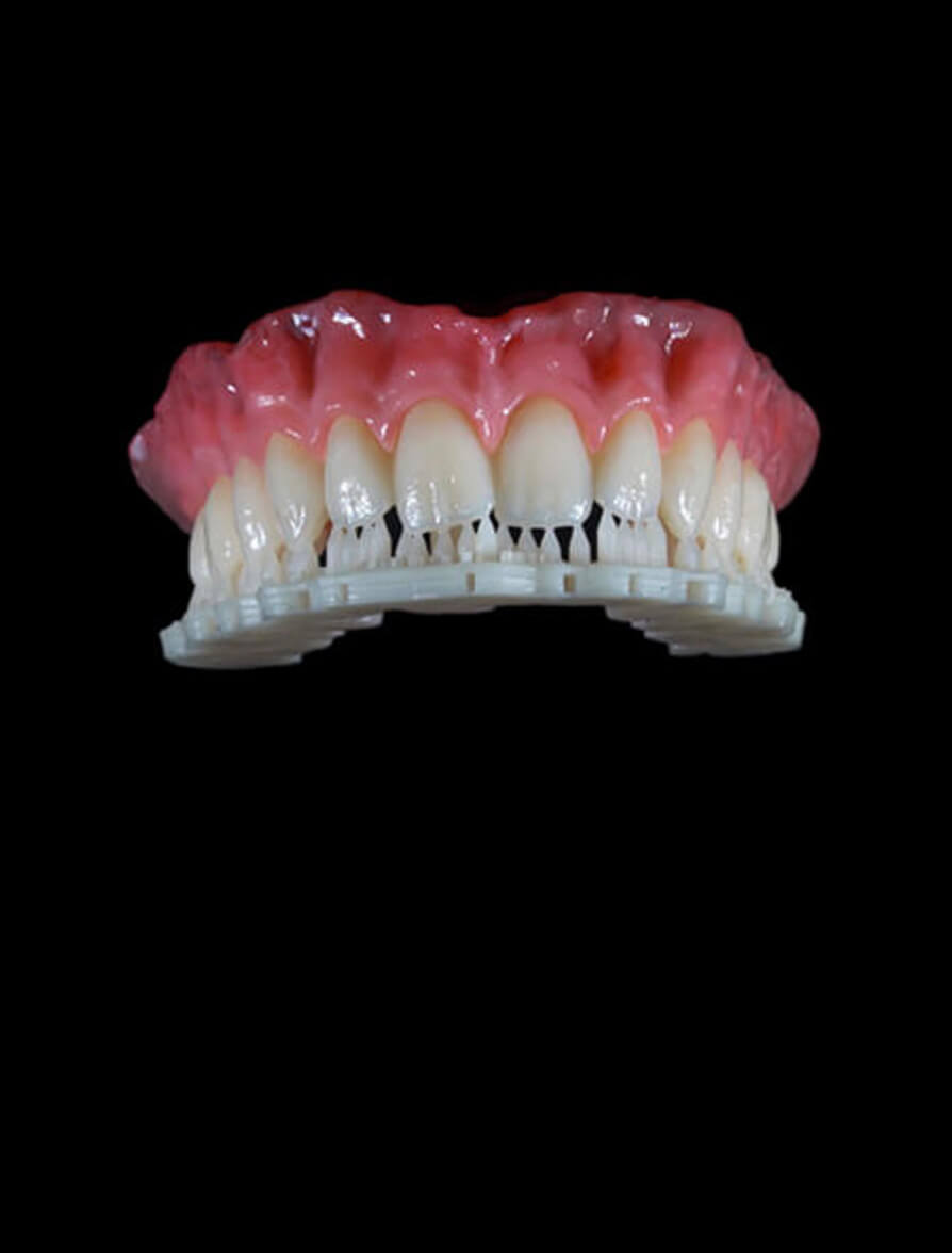 3D Printed Removables Dental CE