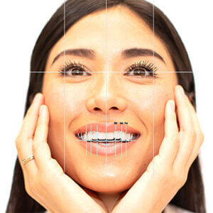 3D Printed Smile Designs and Veneers Course Image