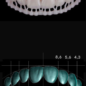 3D Printed Veneers CE Course