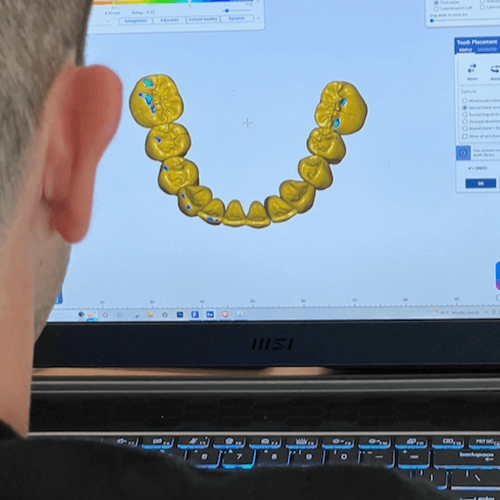 Dental CE exocad