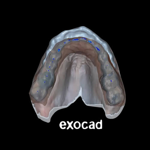 Dental Occlusion CE 3