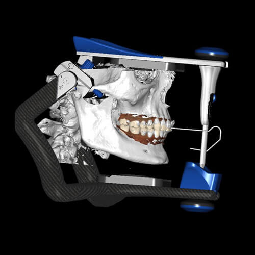 Modern Occlusion