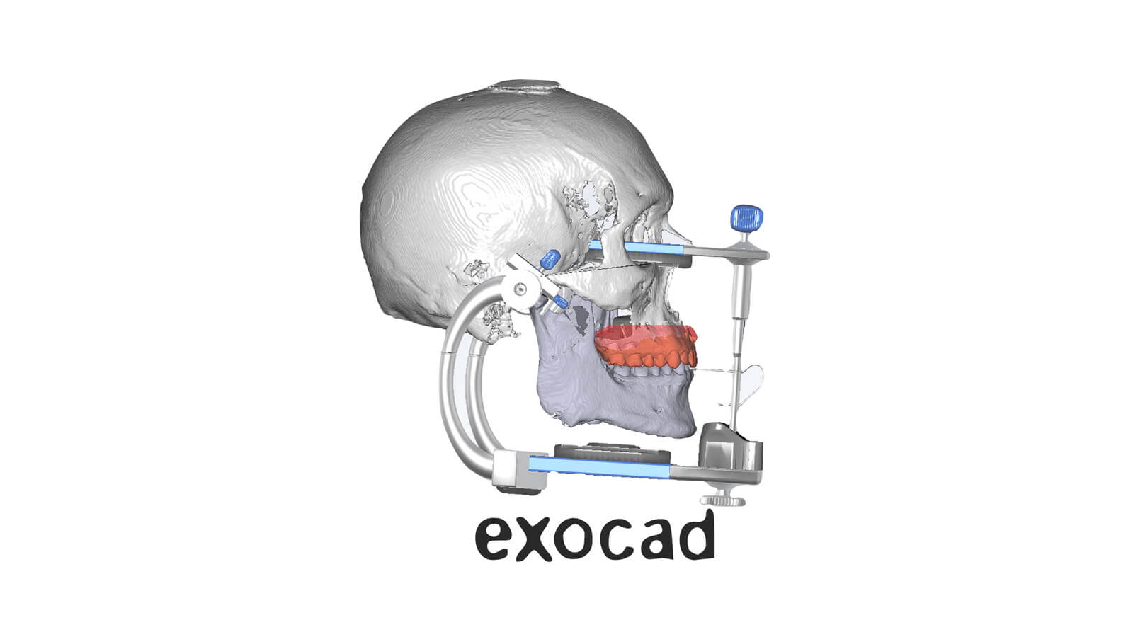 Digital Occlusion Track Level 3