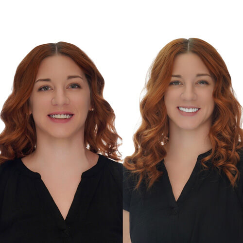 Full Mouth Reconstruction and Removables CE 1