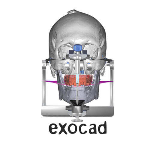 Full Mouth Reconstruction and Removables CE 2