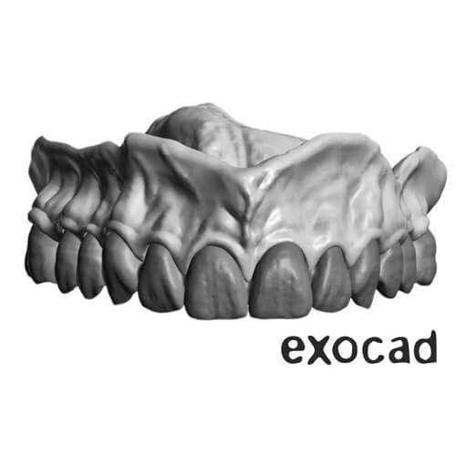 Full Mouth Reconstruction and Removables CE 3