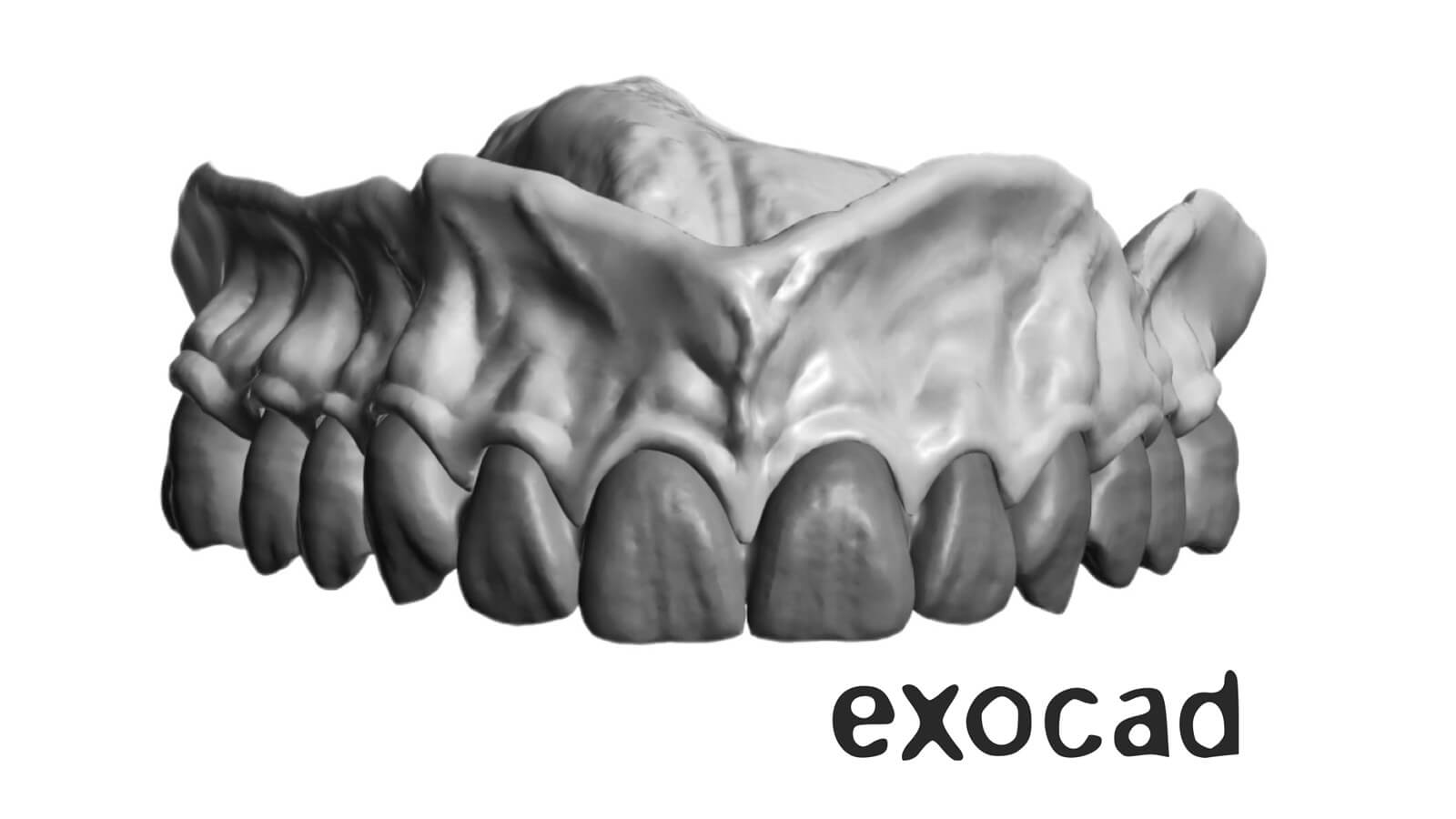 Full Mouth Reconstruction and Removables CE Course Image