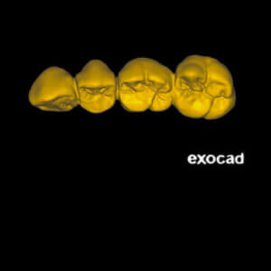 Jumpstart exocad Dental CE