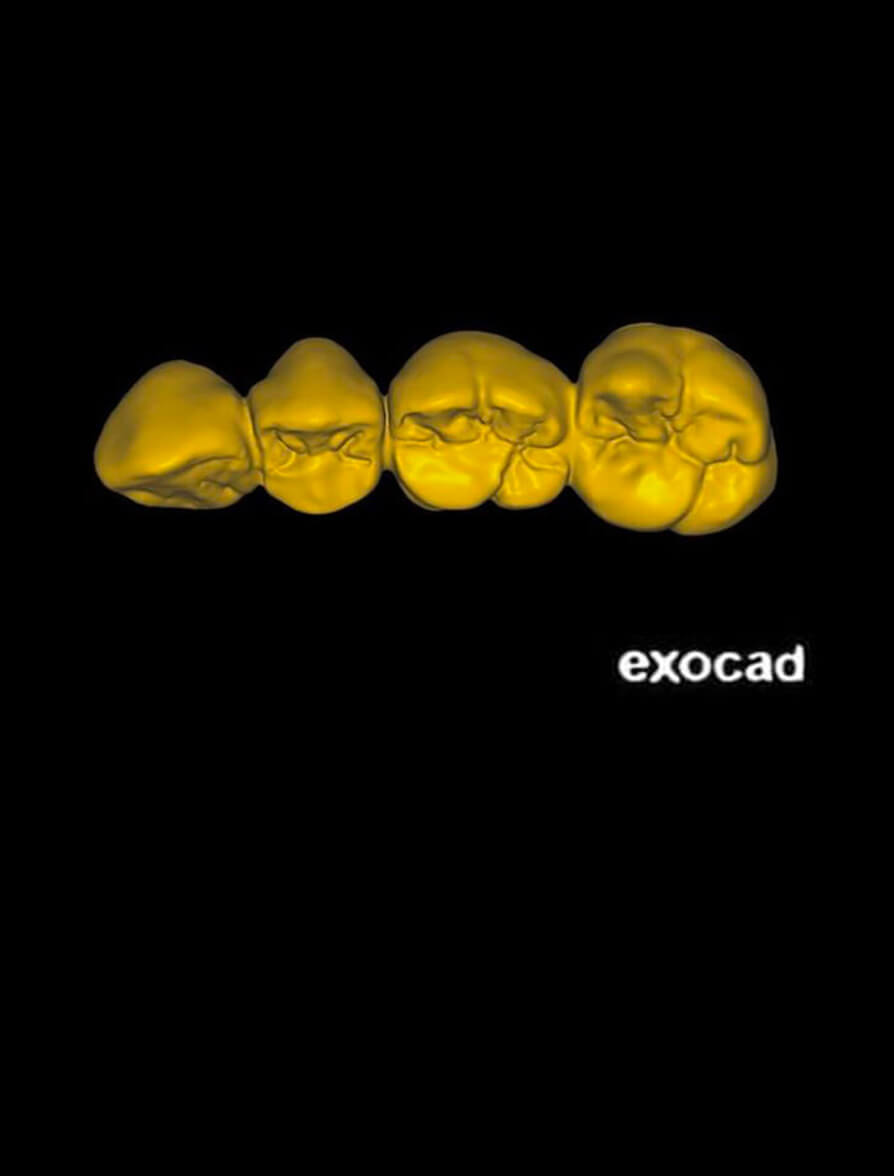 Jumpstart exocad Dental CE