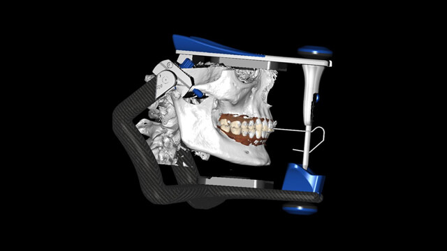 Occlusion Dental CE Level 1