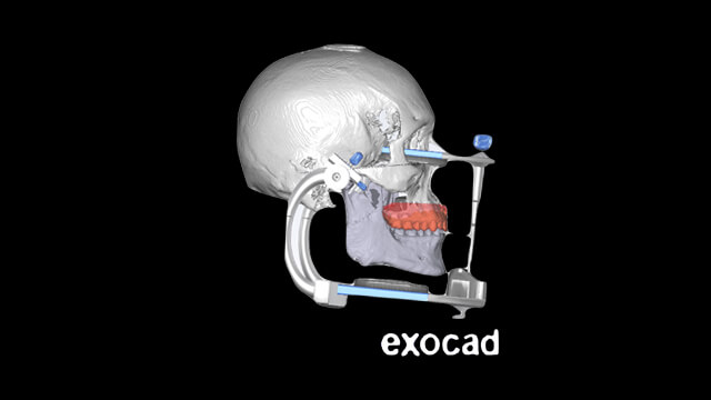 Occlusion Dental CE Level 3