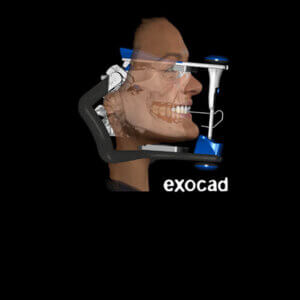 Occlusion Digital Complex Case Planning