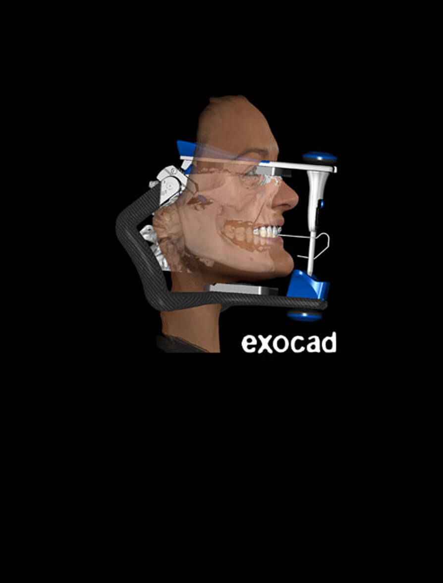 Occlusion Digital Complex Case Planning