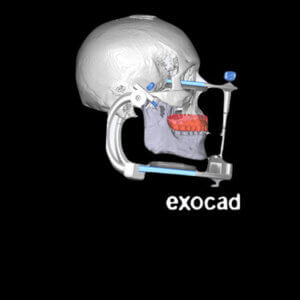 Occlusion Digital Full Mouth Reconstruction