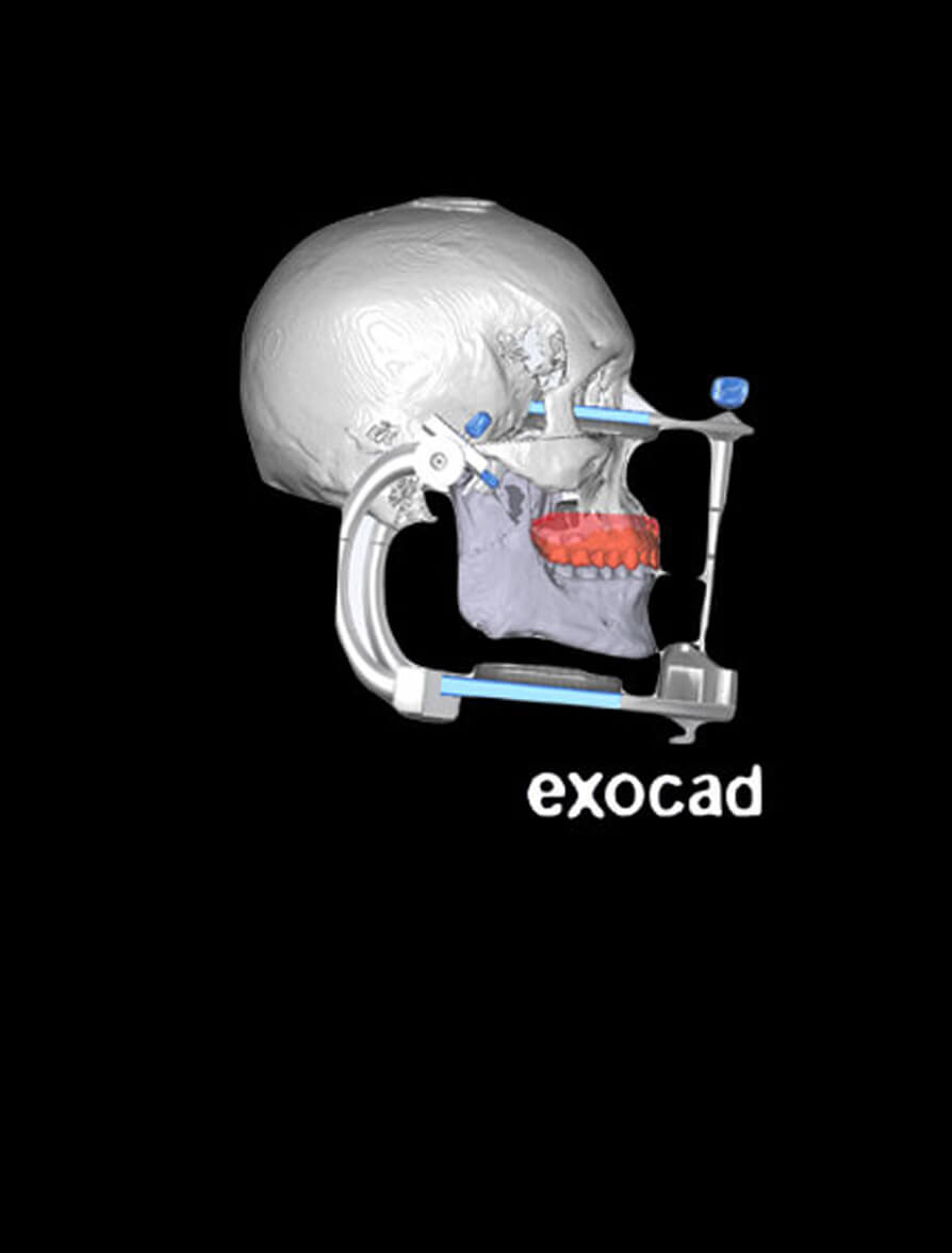 Occlusion Digital Full Mouth Reconstruction