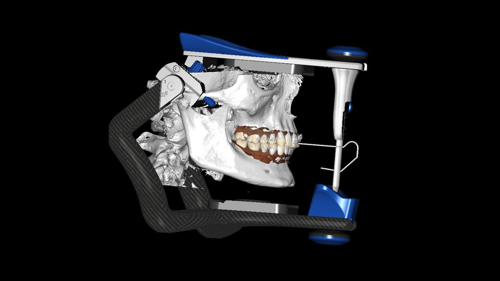 Occlusion Level 1 1600 x 900 Images