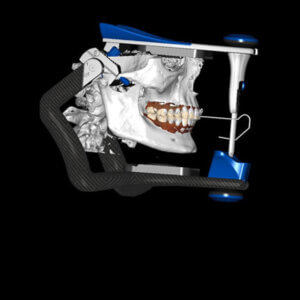 Occlusion Modern Occlusion and Guard Design