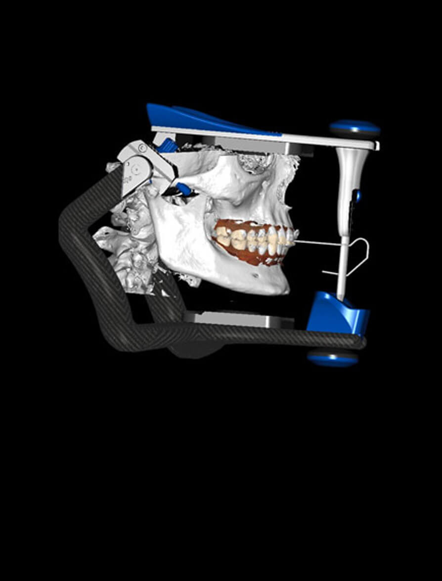 Occlusion Modern Occlusion and Guard Design