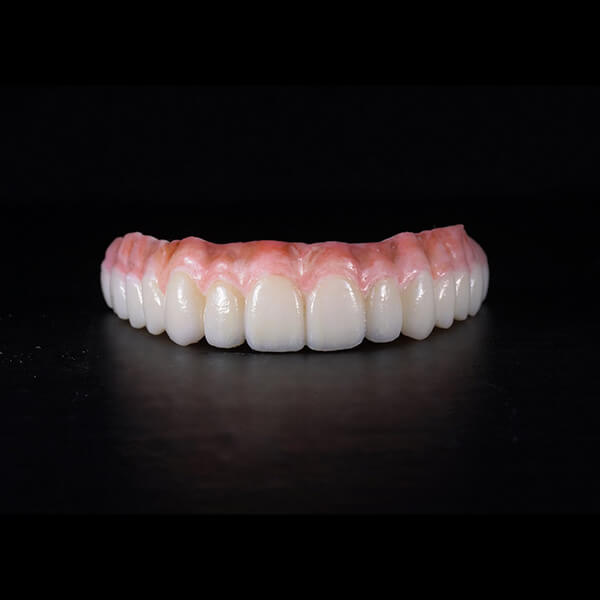 Restoring All on X Dental CE 1