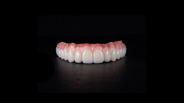 Restoring All on X Dental CE