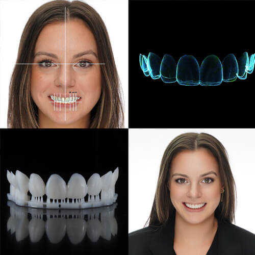 aesthetics and smile design dental ce model