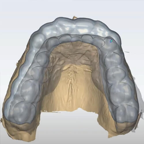 aesthetics and smile design dental ce guard design