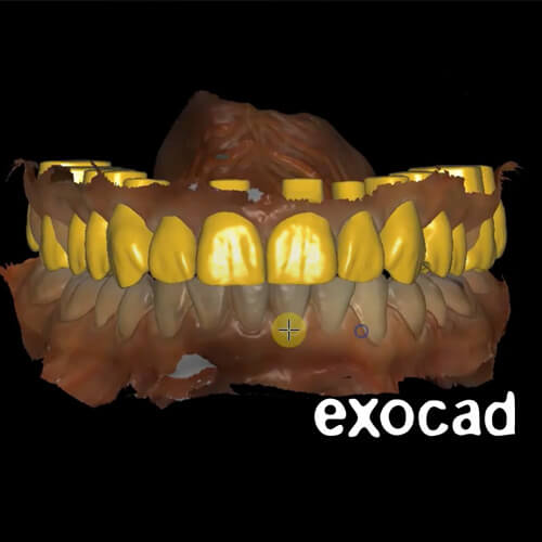 aesthetics and smile design dental ce 3