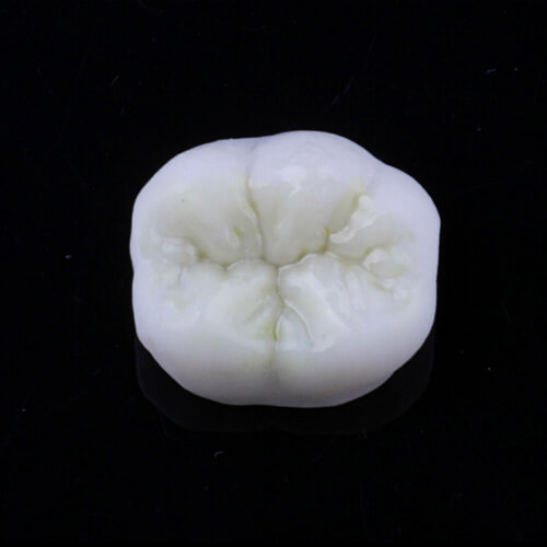 aesthetics and smile design dental ce tooth