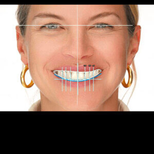 excoad Design level 2 Dental CE