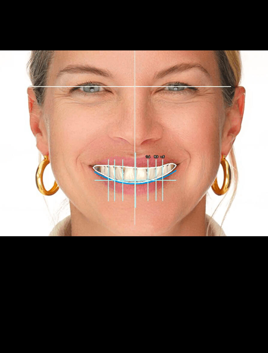 excoad Design level 2 Dental CE