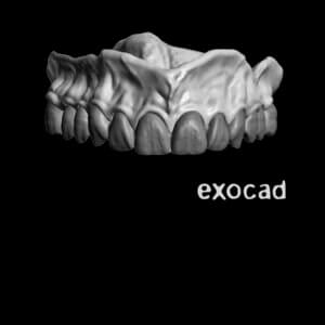 excoad Design level 3 Full Mouth Dental CE