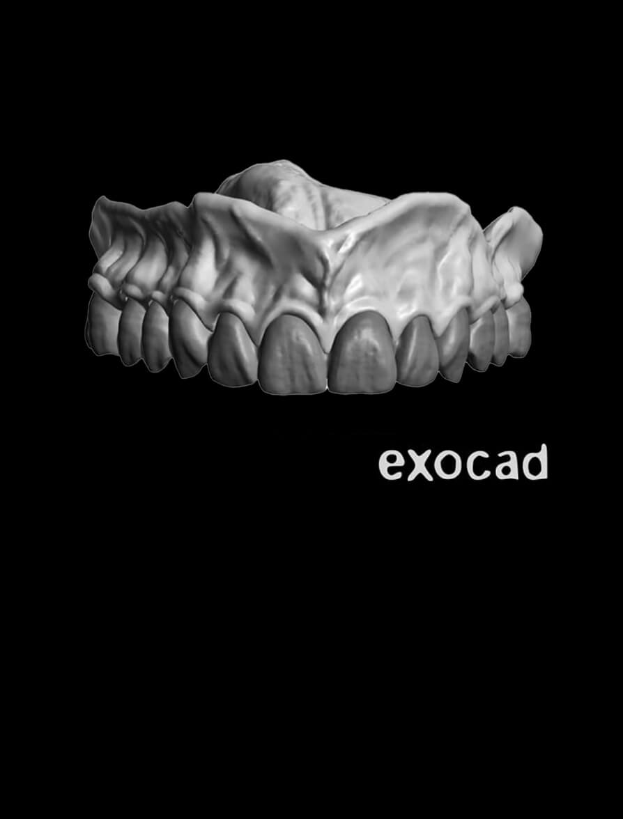 excoad Design level 3 Full Mouth Dental CE