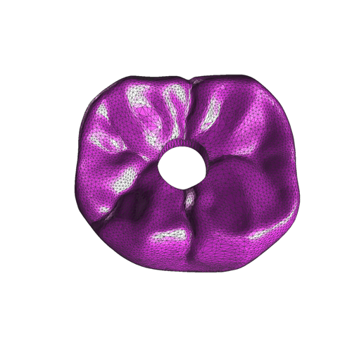 exocad Design Image 1