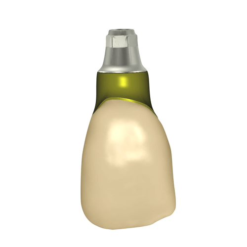 exocad Design Image 4