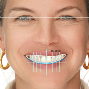 exocad Design Level 2 Course