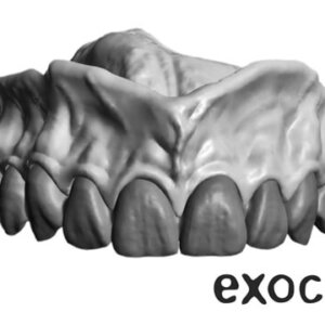 exocad Design Level 3 Course