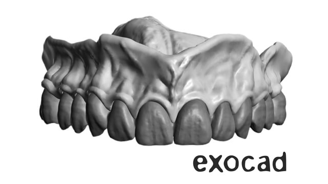 exocad Design Level 3 Course