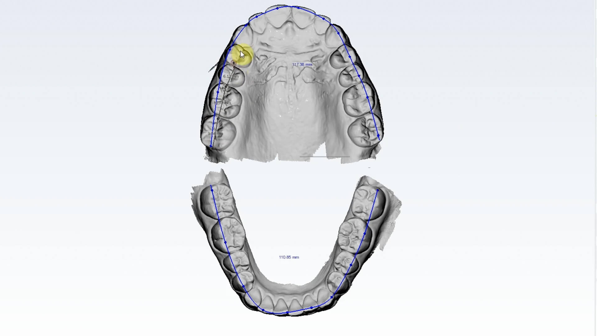 Full Arch Scanning