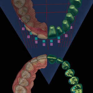 Full Mouth Restoration Mini-Residency CE Course Card