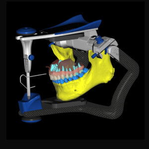 Advanced Occlusal Design in exocad CE Course