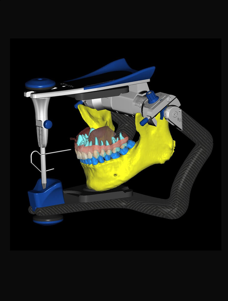 Advanced Occlusal Design in exocad CE Course