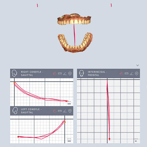 Advanced Occlusion
