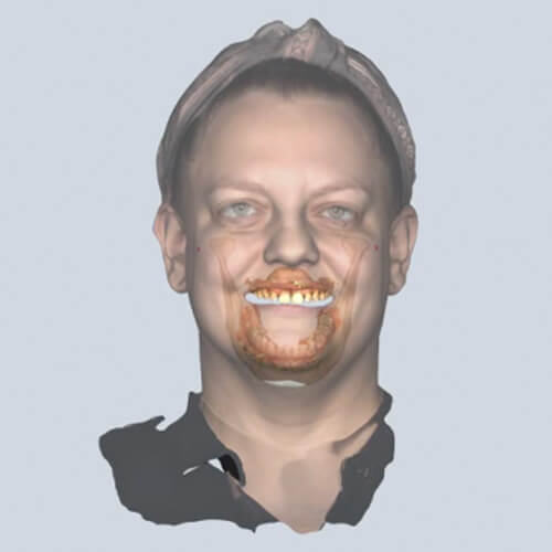 MODjaw Tracing