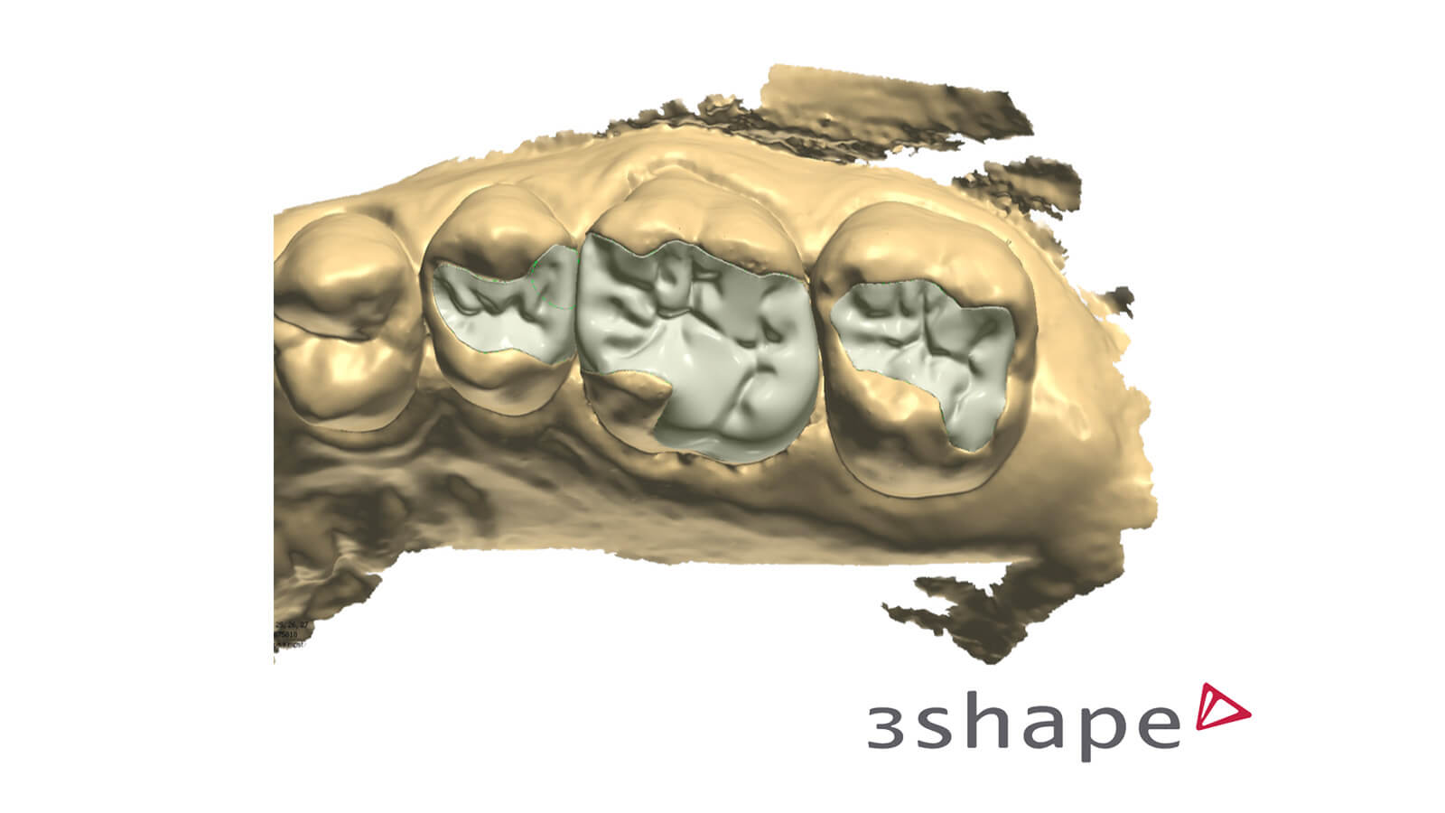 Jumpstart 3Shape Design Studio