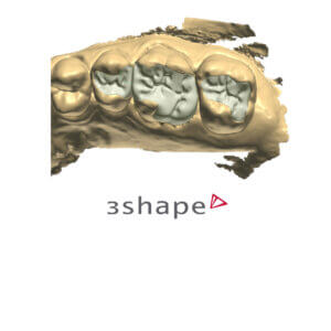 Jumpstart 3Shape Product Card