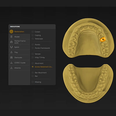 InLab Design 1