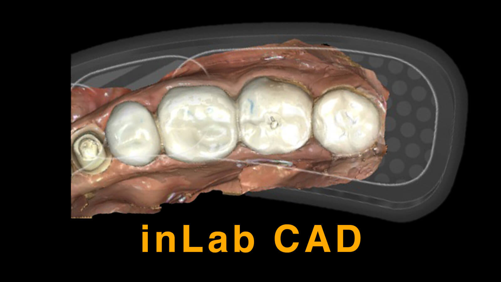 inLab CAD Design CE